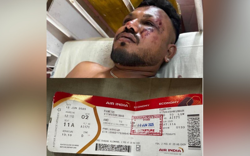 Ajaib! Cerita dan Kesaksian Ramesh, Satu-satunya Penumpang Air India yang Selamat: Orang-orang Terbakar